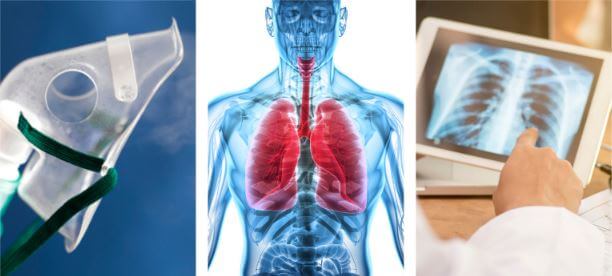 triptych of images related to medical lung treatment including a respiratory mask, lung graphic and lung xray